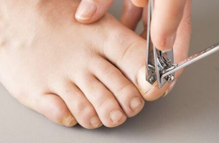 Causes of fungi on nails