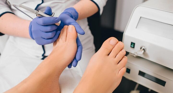 professional treatment for toenail fungus