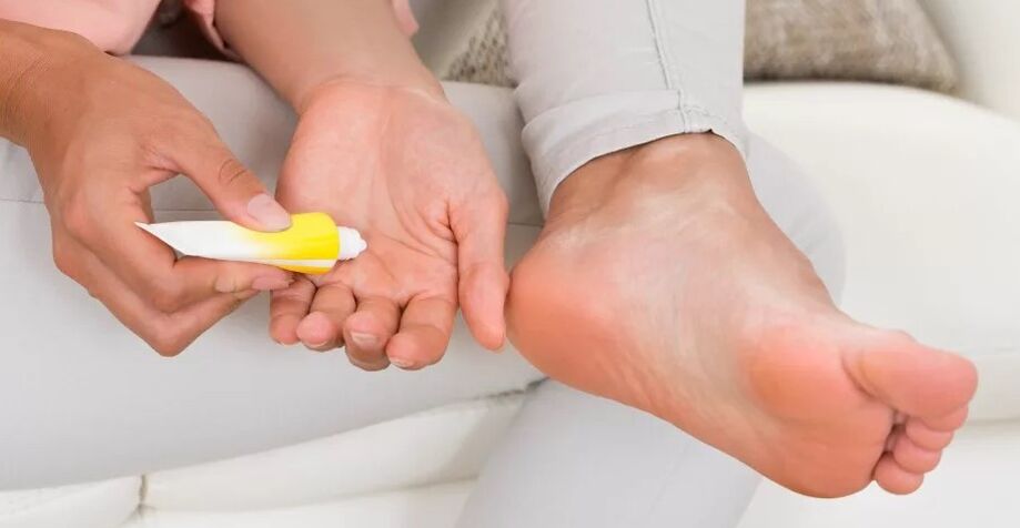Foot fungus ointment